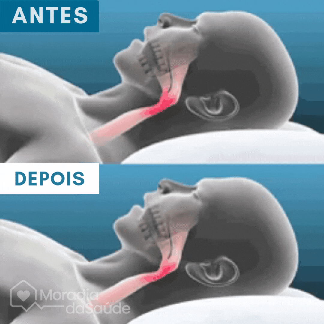 Protector bucal antironquidos Znorex®